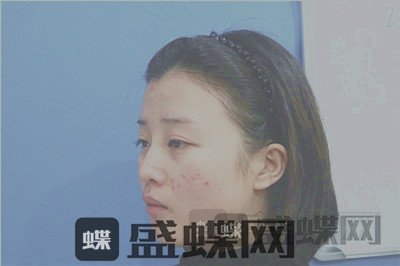 杭州格莱美，张龙，，案例，价格，