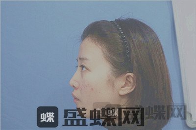 杭州格莱美，张龙，，案例，价格，