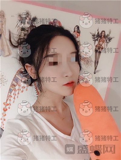 上海华美，李志海，下颌角整形，案例，价格，