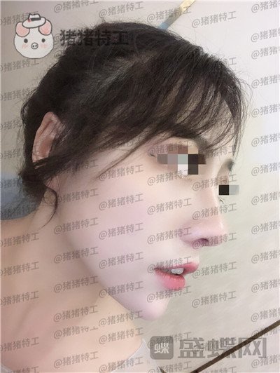 云南华美美莱，洪晓娅，，案例，价格，