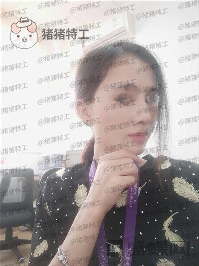 长沙美莱，斌，，案例，价格，