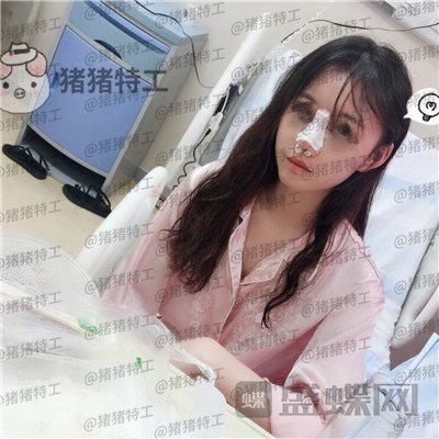 苏州美莱，吴蓉，，案例，价格，