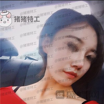 苏州美莱，吴蓉，，案例，价格，