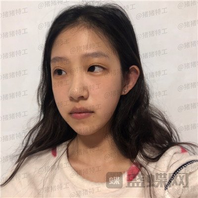 杭州美莱，韩超，，案例，价格，